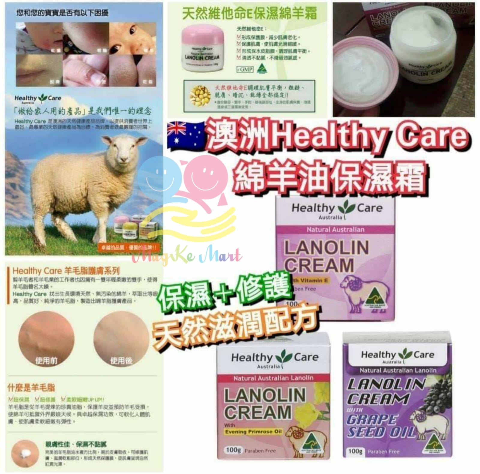 澳洲 Healthy Care 綿羊油保濕霜