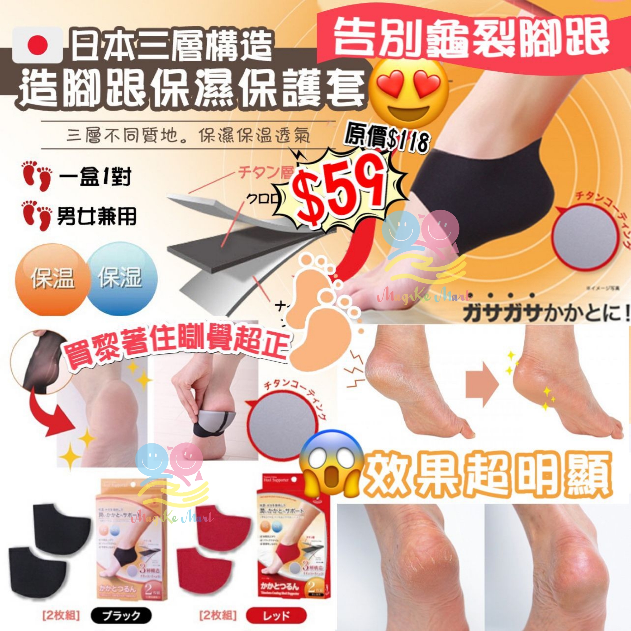 日本三層構造腳跟保濕保護套(1盒2枚)(顏色隨機)